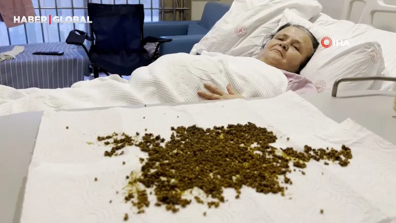 Doktorları şoke eden operasyon: "20 binden fazla taş çıktı!"