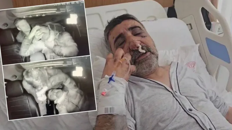 Boksörün Saldırdığı Taksici Anlattı: Öptü, Isırdı, Gözümü Oydu!