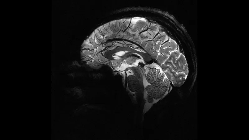 Yapay Zeka Mucizesi! Epilepsi Hastası Çocuklara Umut Işığı